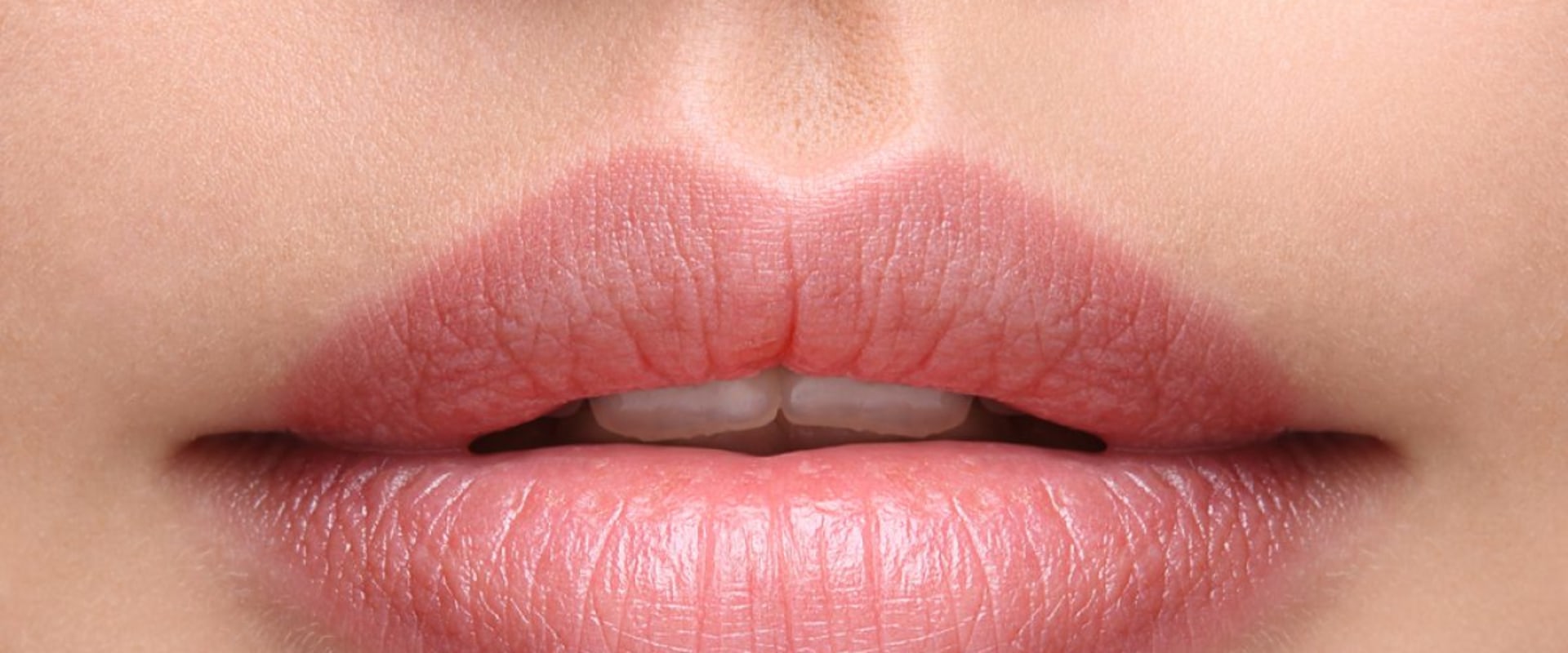 Which Dermal Filler Lasts the Longest?