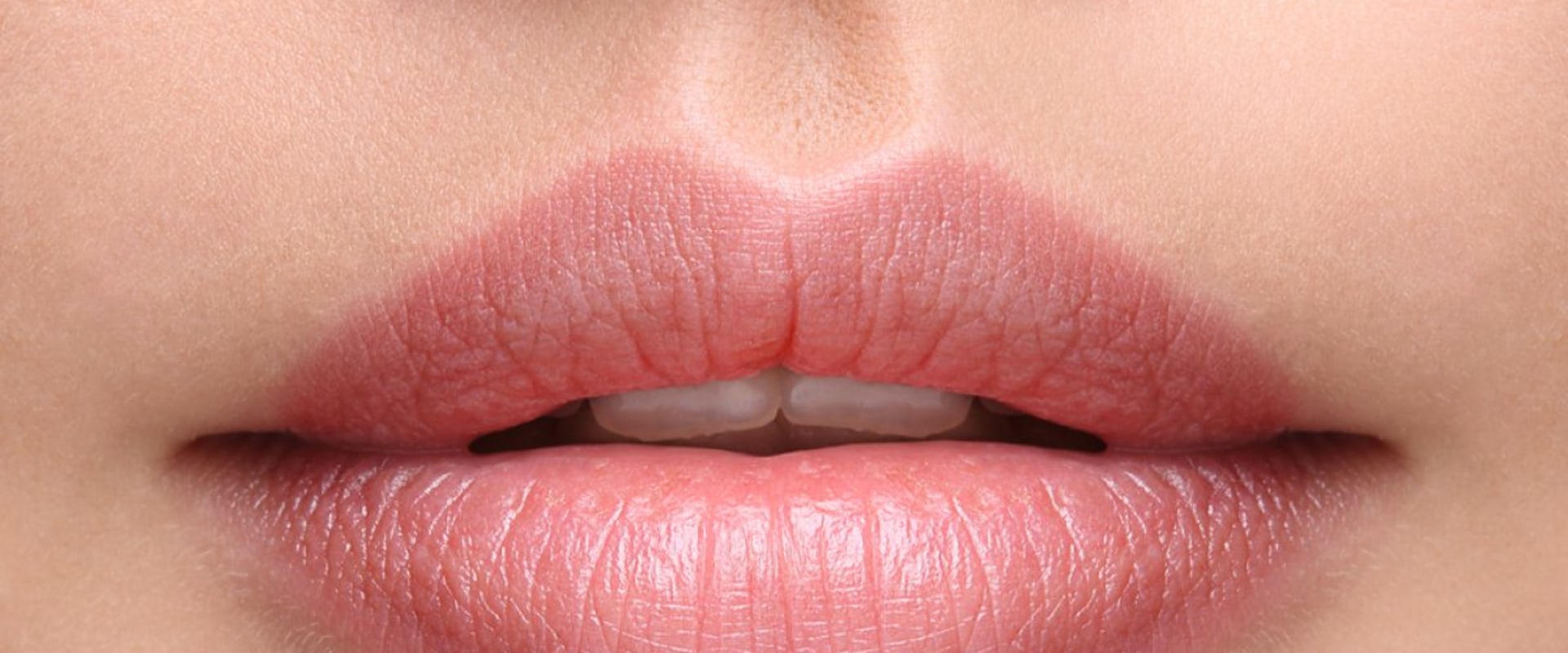 Which type of juvederm lasts the longest?