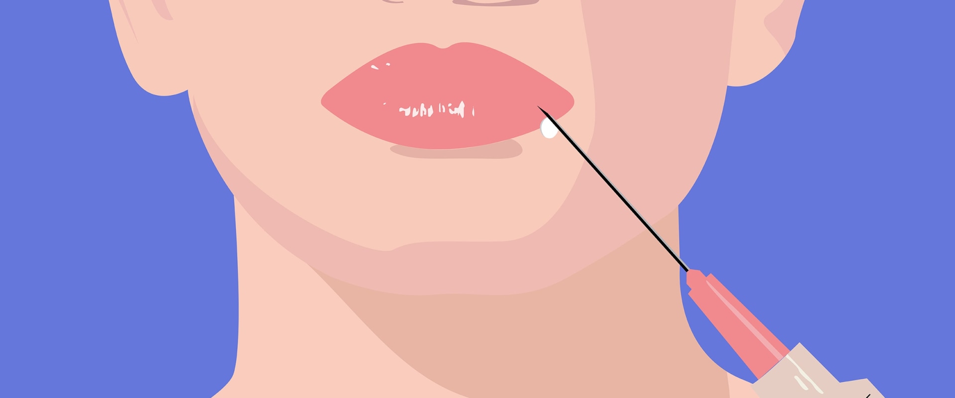 Where else can you inject juvederm?