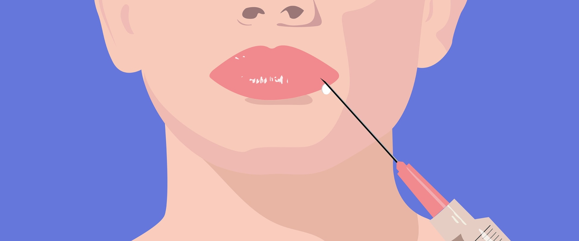 Where Should You Not Put Dermal Fillers?