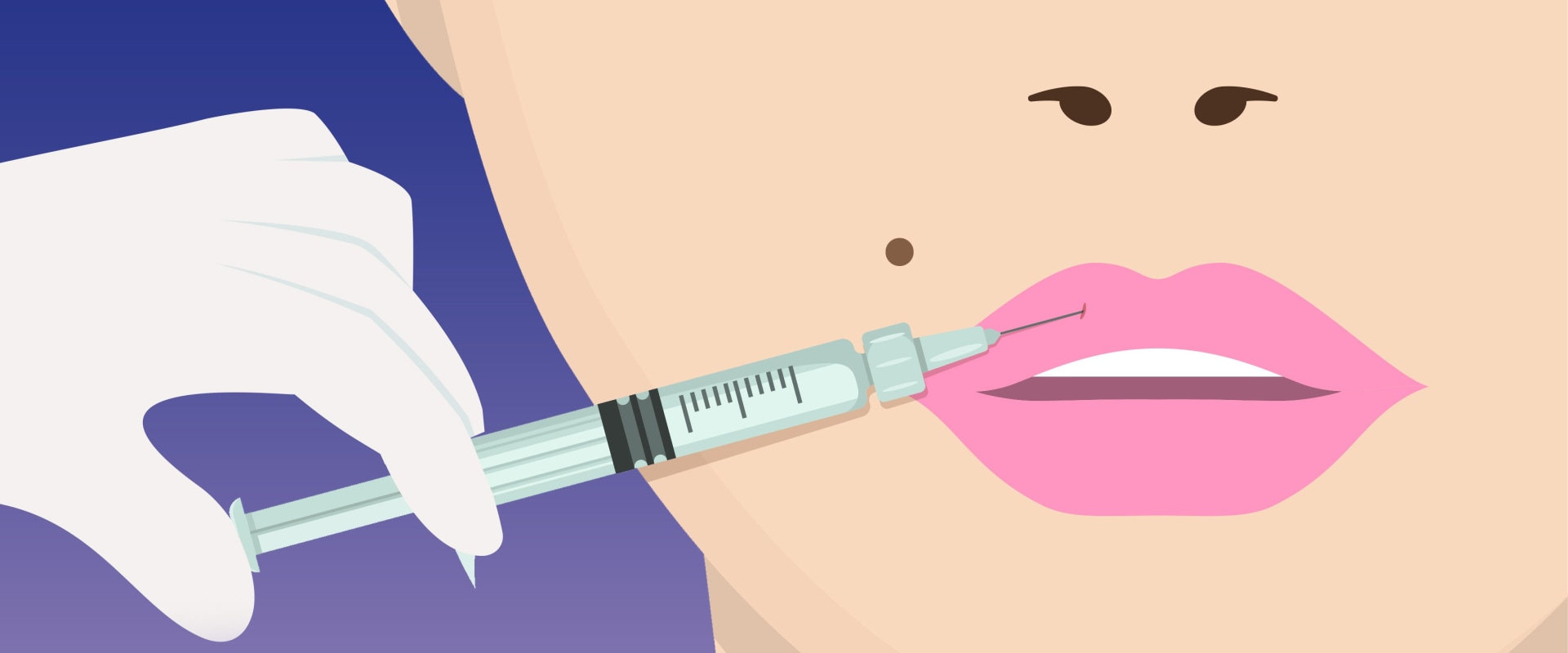 What Company Makes Lip Fillers?