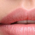 Which type of juvederm lasts the longest?