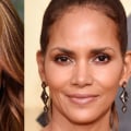 Who Owns Botox Now? An Expert's Perspective