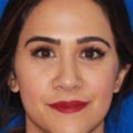 What Juvederm Filler is Used for Under Eyes? - An Expert's Perspective