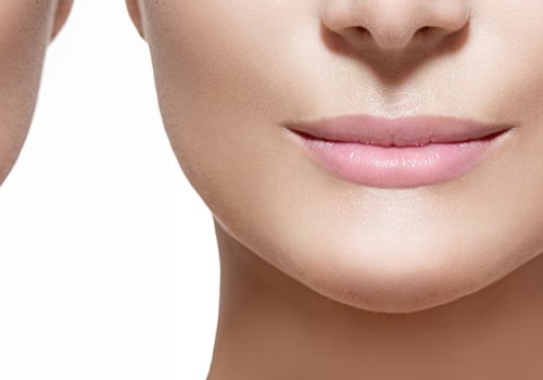 How Long Do Fillers Last? An Expert's Guide