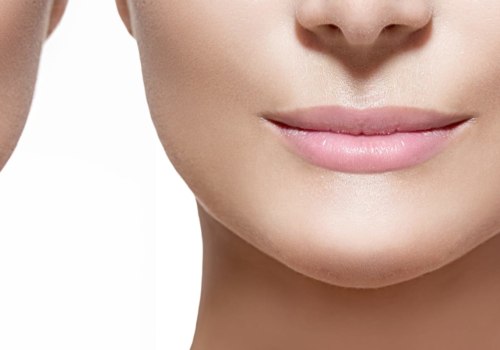 Is juvederm in lips safe?