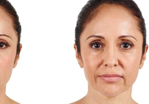 What Can Juvederm Do For Your Face?