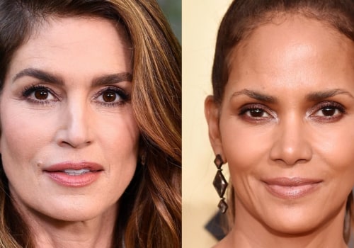 Who Owns Botox Now? An Expert's Perspective