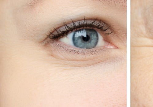 Which Treatment is Best for Forehead Wrinkles: Botox or Juvederm?