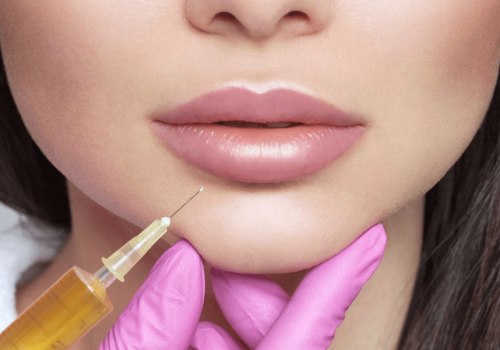 Which Juvederm is Best for Lip Volume?
