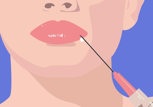 Where should you not put fillers?